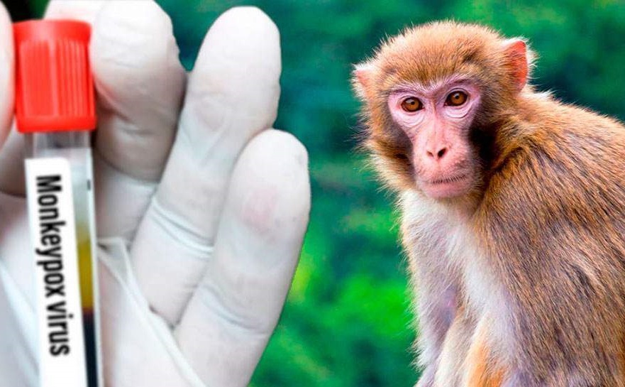 В России выявили первого заболевшего оспой обезьян