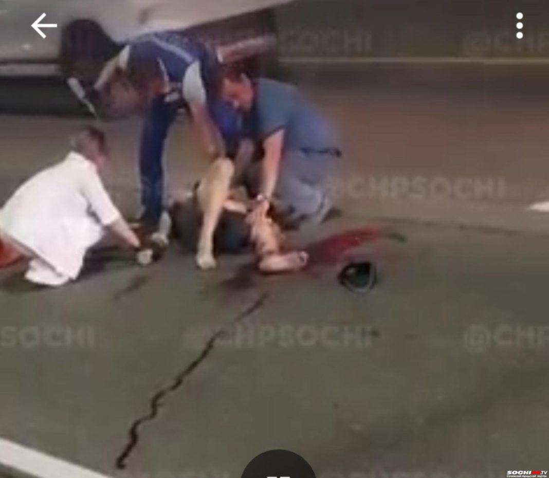 Раздробило ногу: в Сочи человек попал под машину