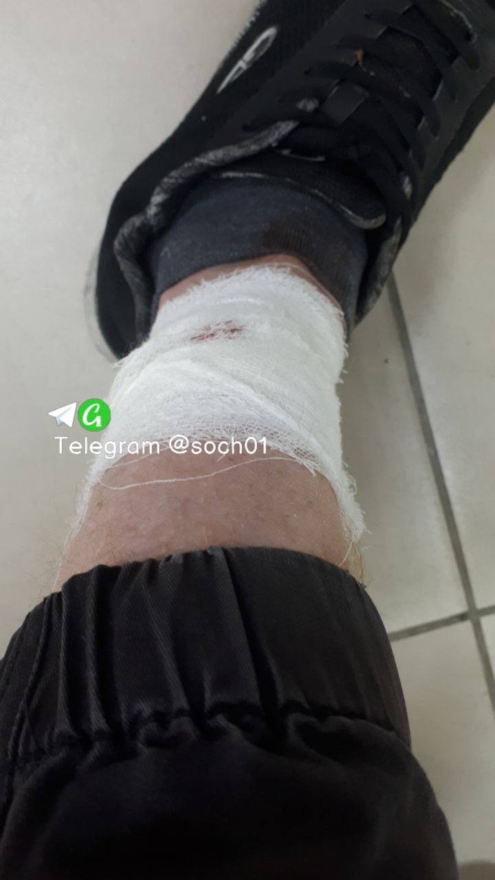 «Шерстяная тварь» укусила мужчину в Сочи