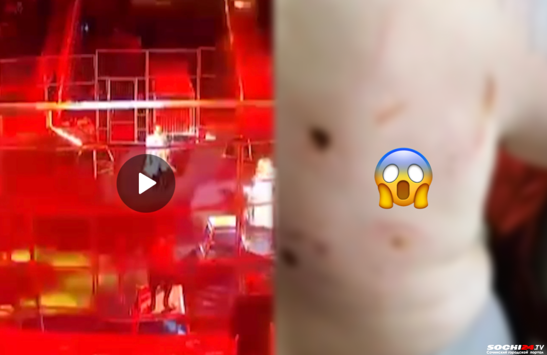 Шок-контент! Последствия нападения льва на дрессировщика в Сочи (Видео)