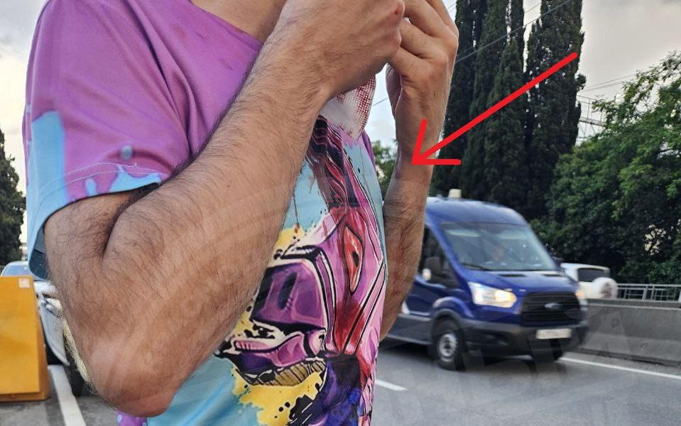 Кровавая дорожная разборка: в Сочи подрались участники ДТП