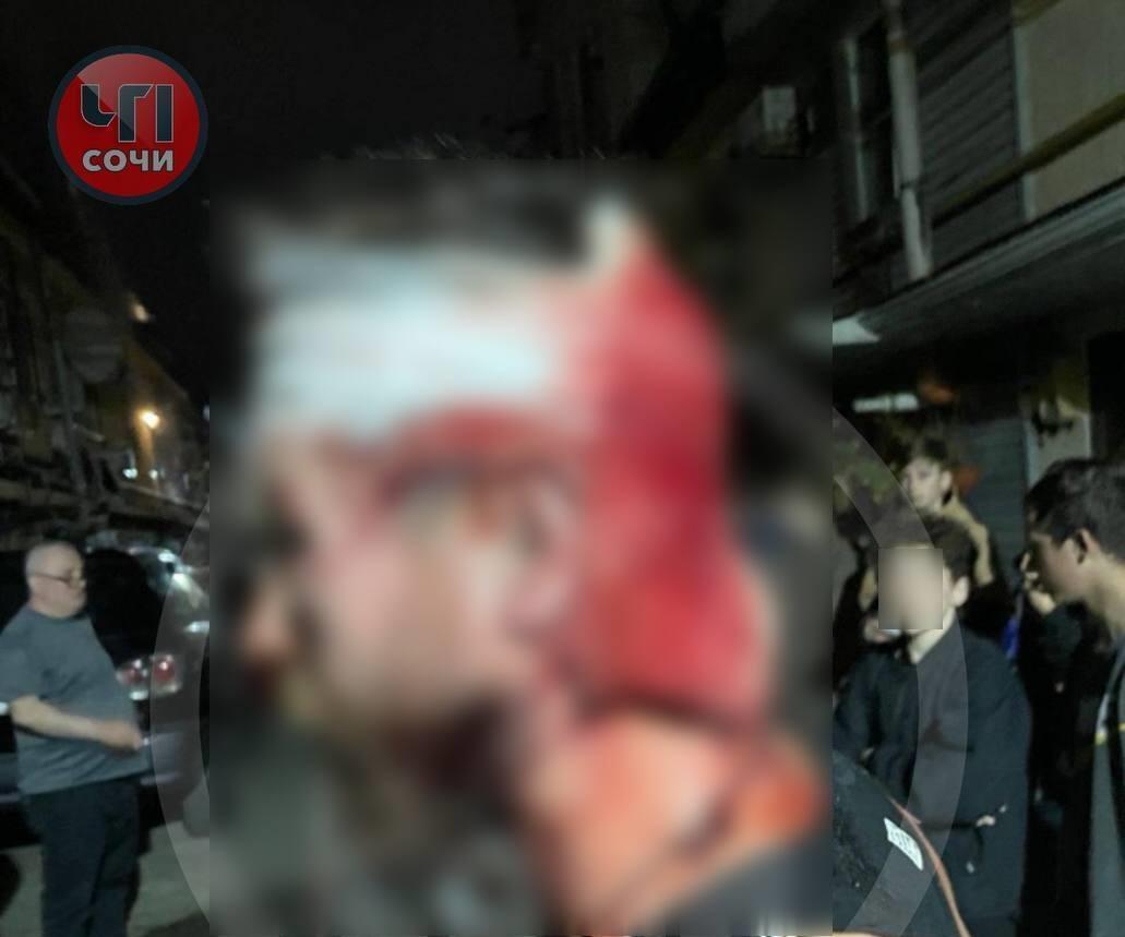 В Сочи толпа людей избила мужчину