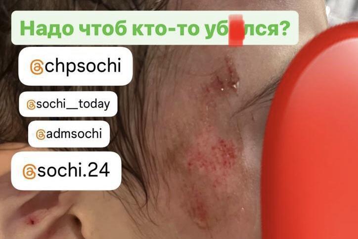 Дети в опасности: площадка на улице Мира в Адлера находится в ужасном состоянии