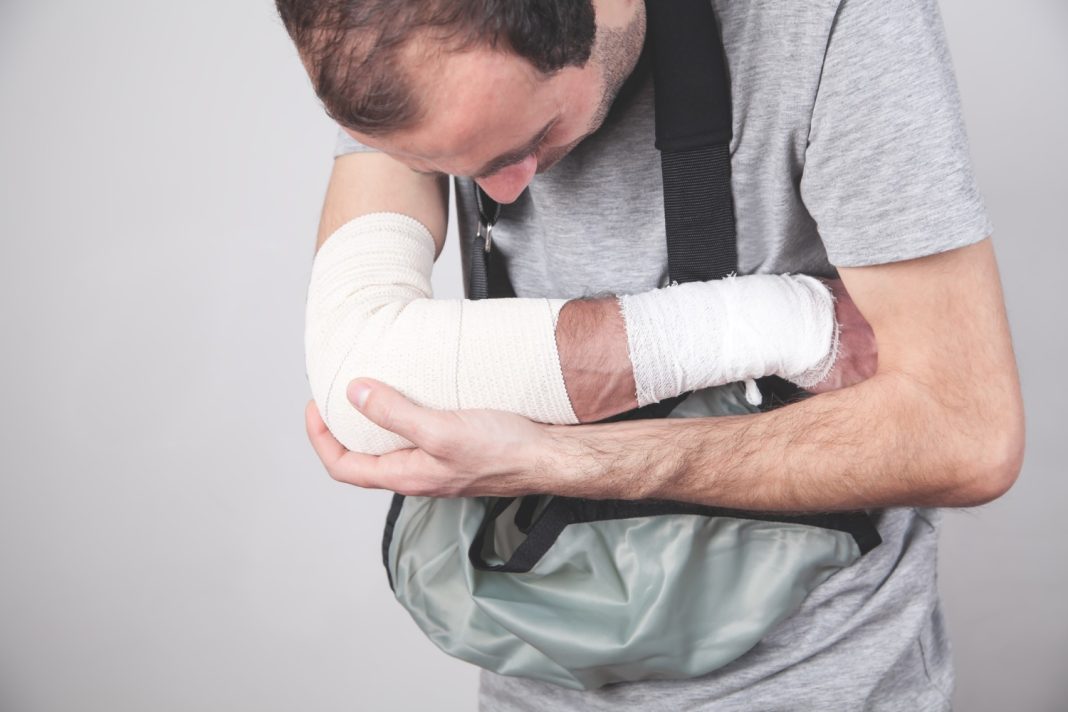 За решетку в гипсе: невезучего «однорукого бандита» задержали в Сочи за кражу смартфона