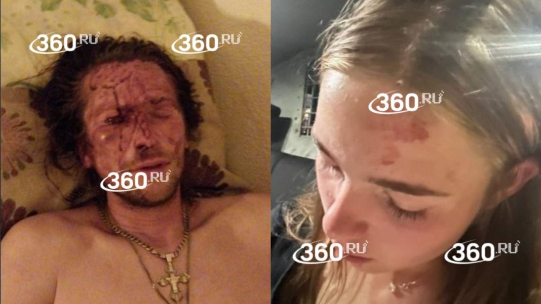 Отказ в знакомстве обернулся дракой: туристов жестоко избили в Анапе