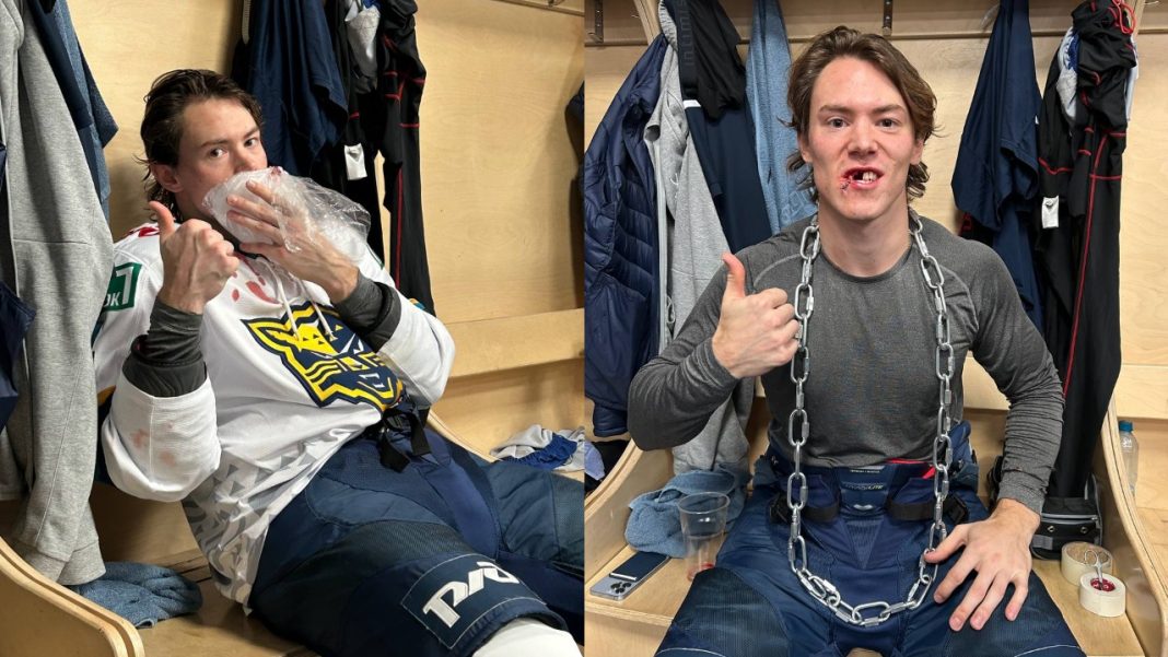 Коньком по лицу: защитник «Сочи» потерял зубы в матче с ЦСКА