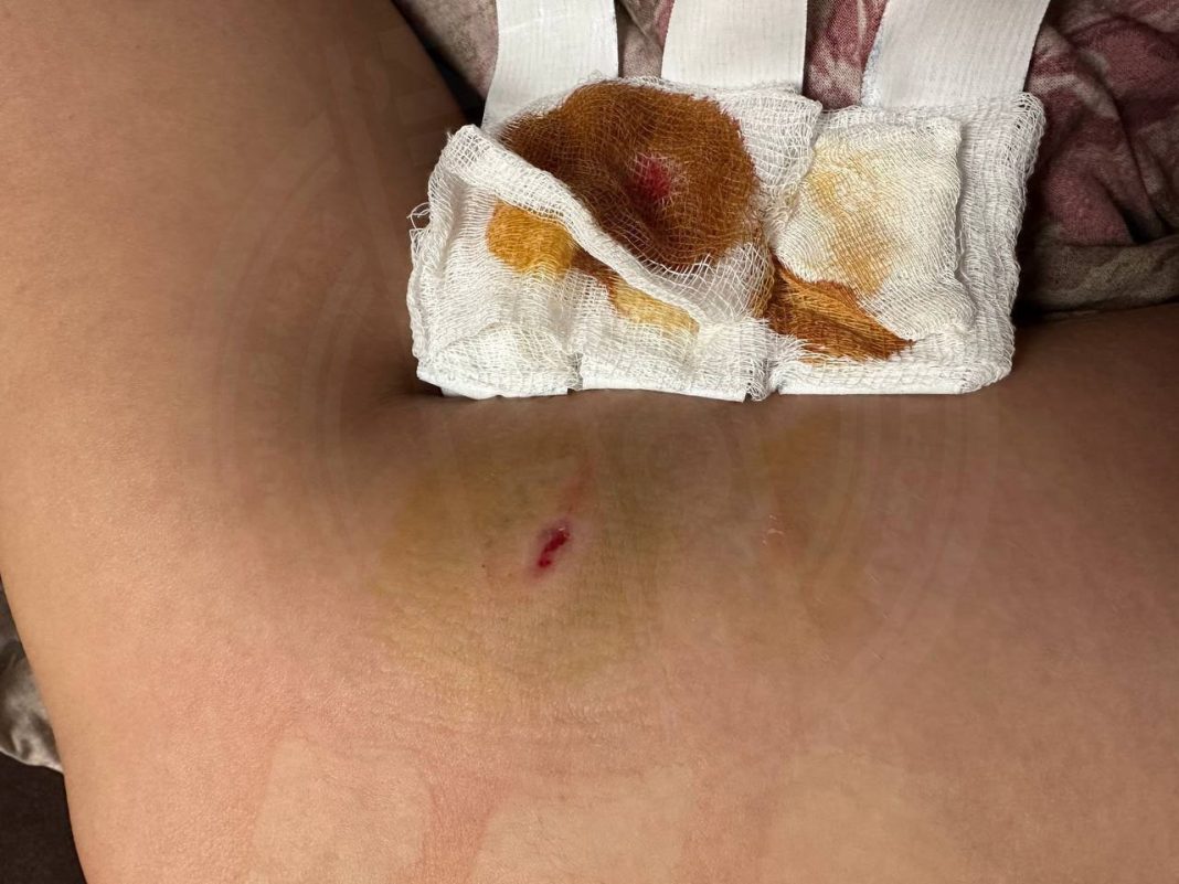 Соцсети: уличные псы терроризируют жителей поселка Дагомыс