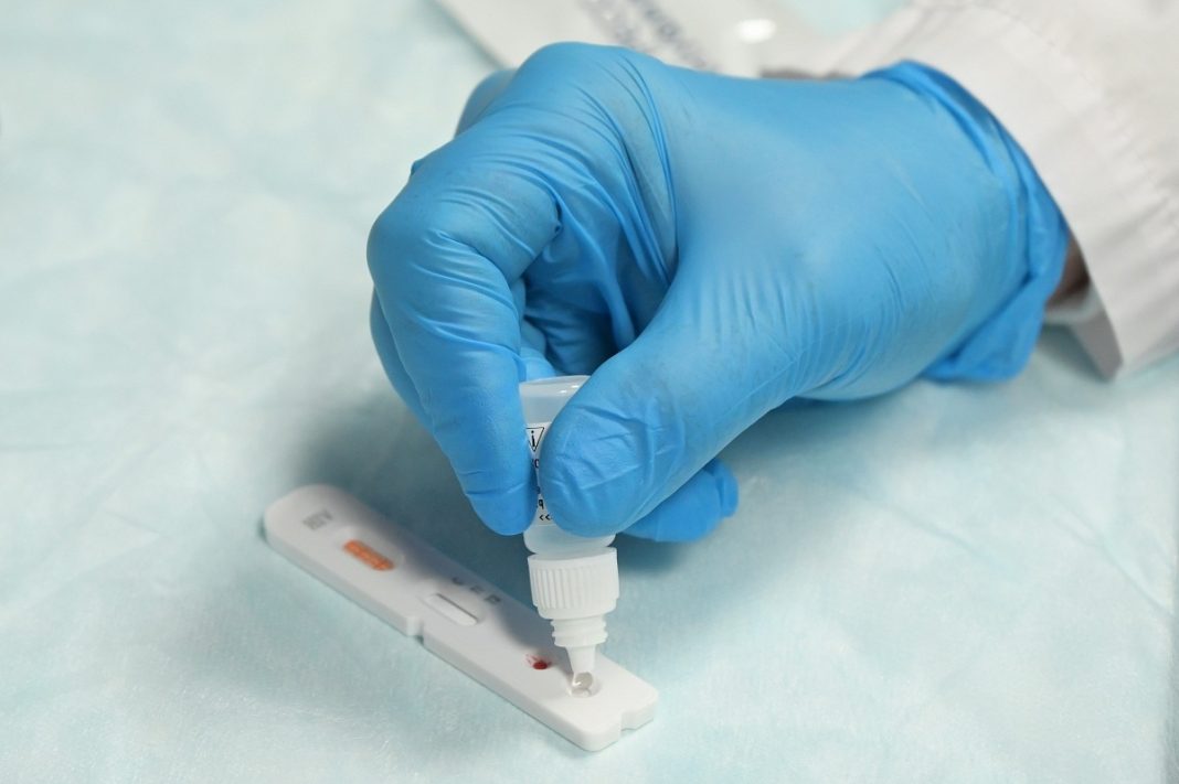 «Узнай свой статус»: в Сочи провели акцию с экспресс-тестами на ВИЧ для студентов